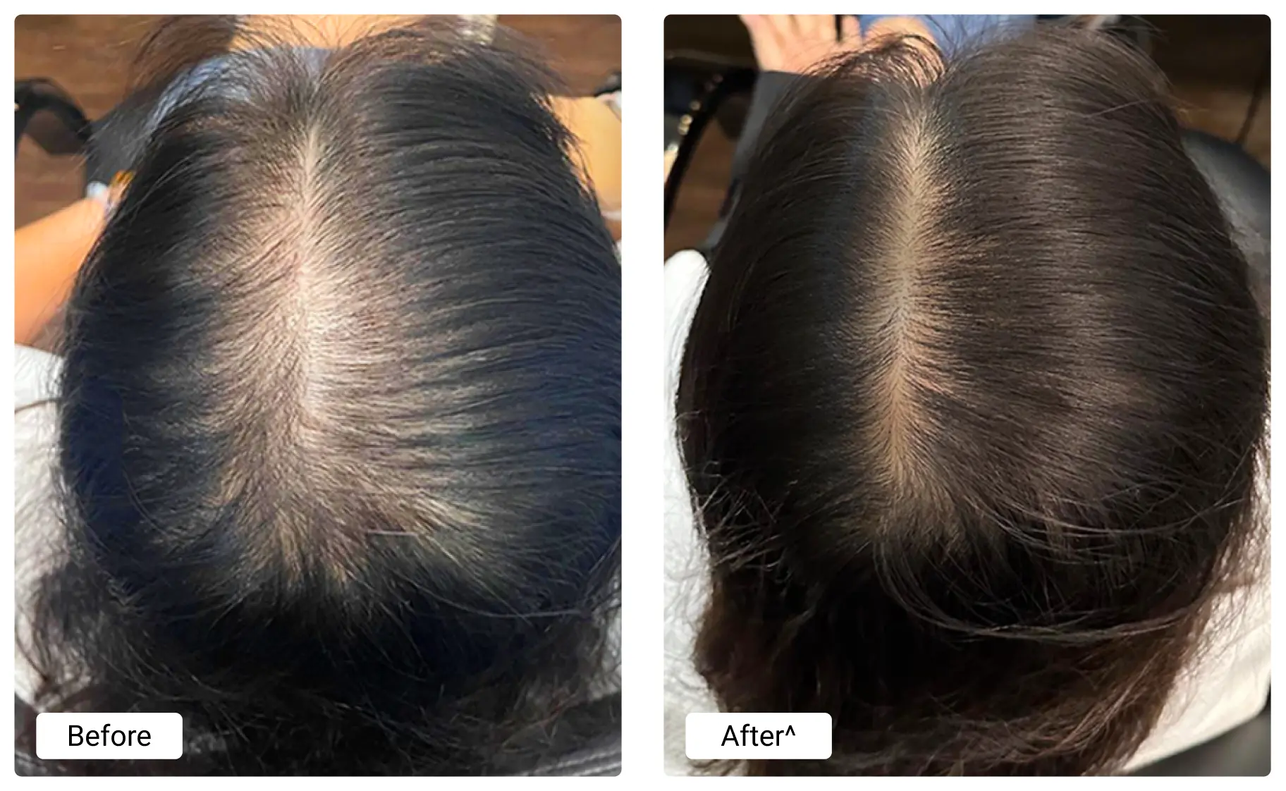 before-and-after (1)