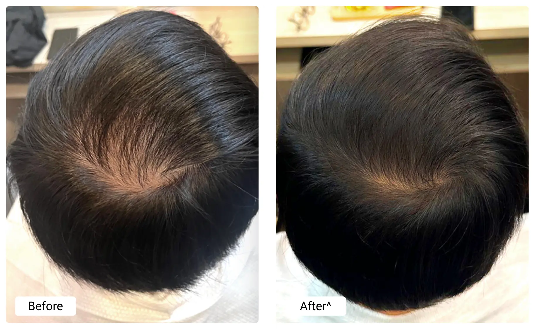 before-and-after (2)
