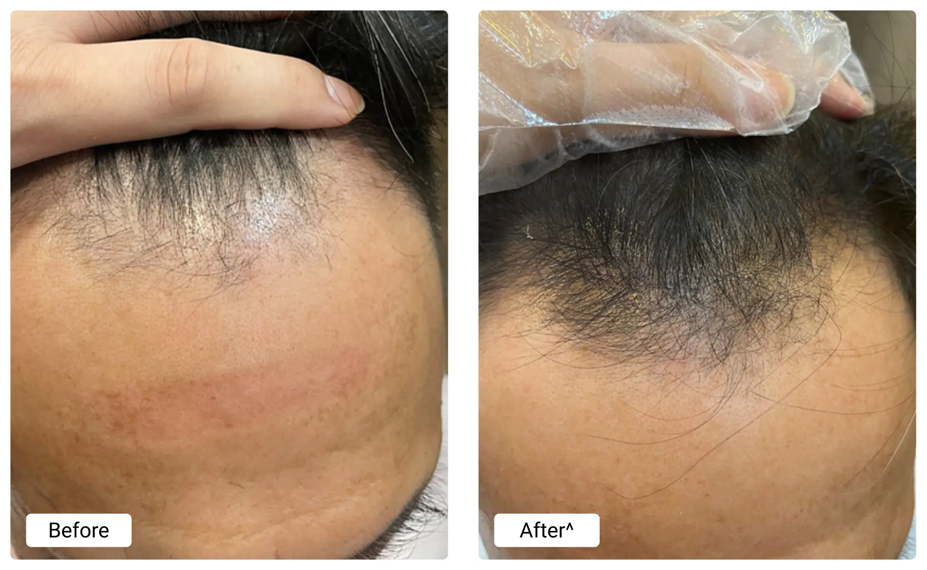 before-and-after (3)