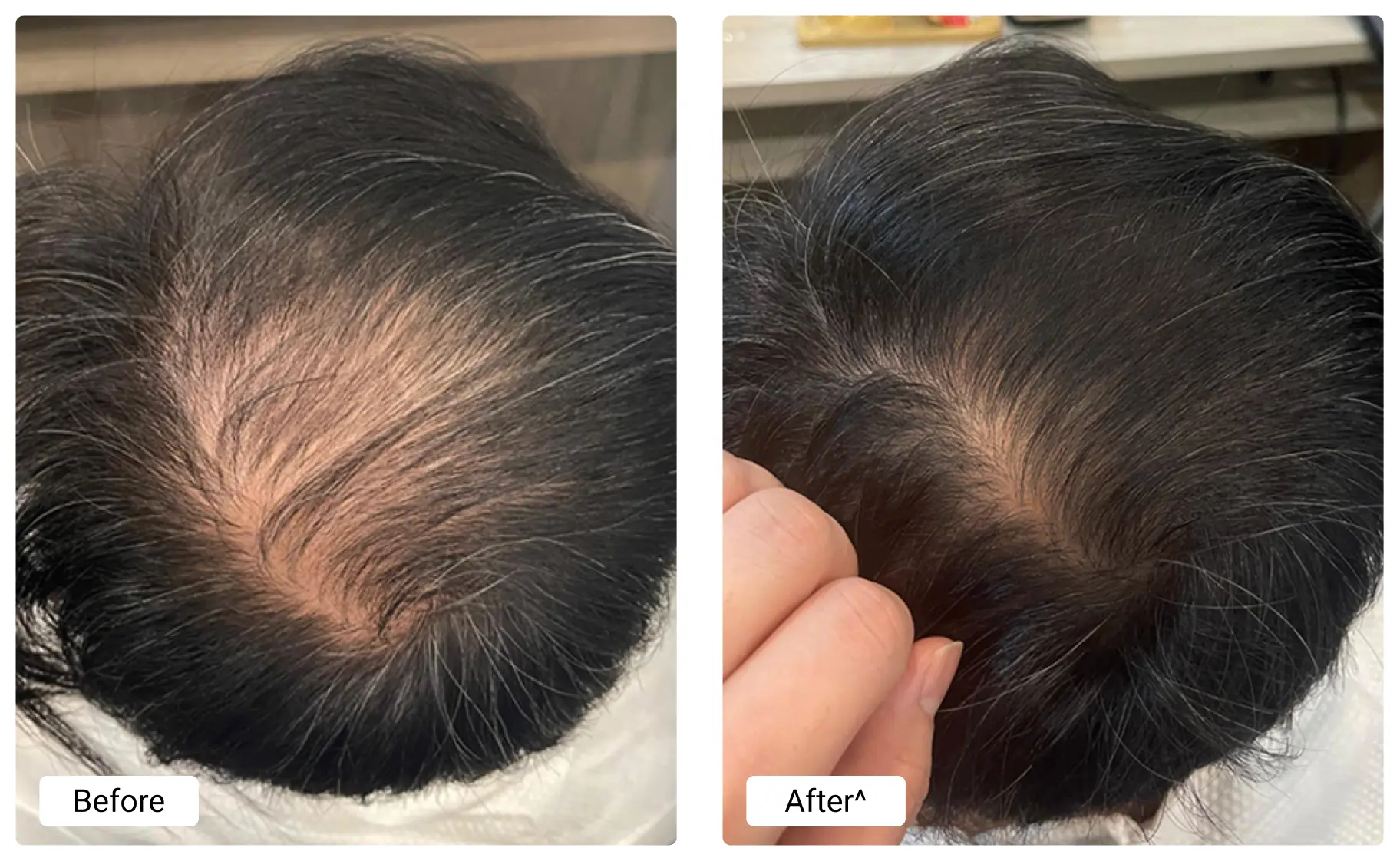 before-and-after (4)