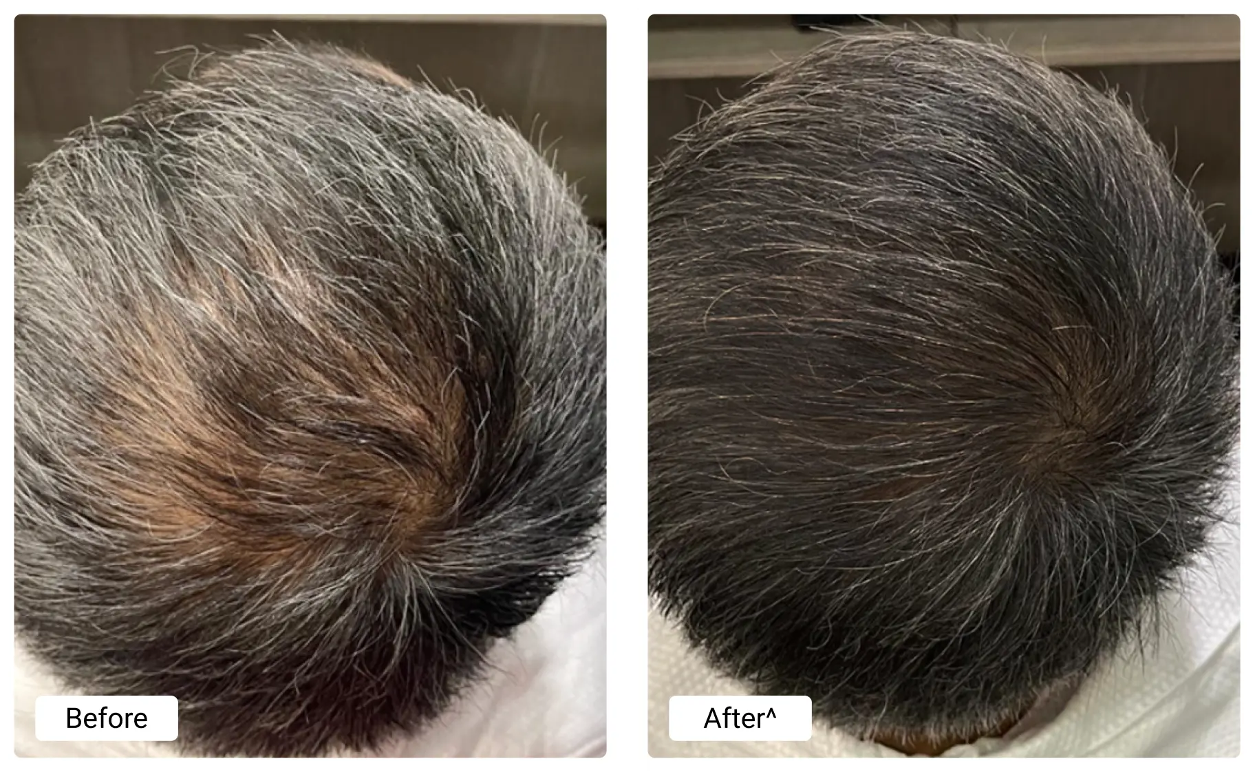 before-and-after (5)