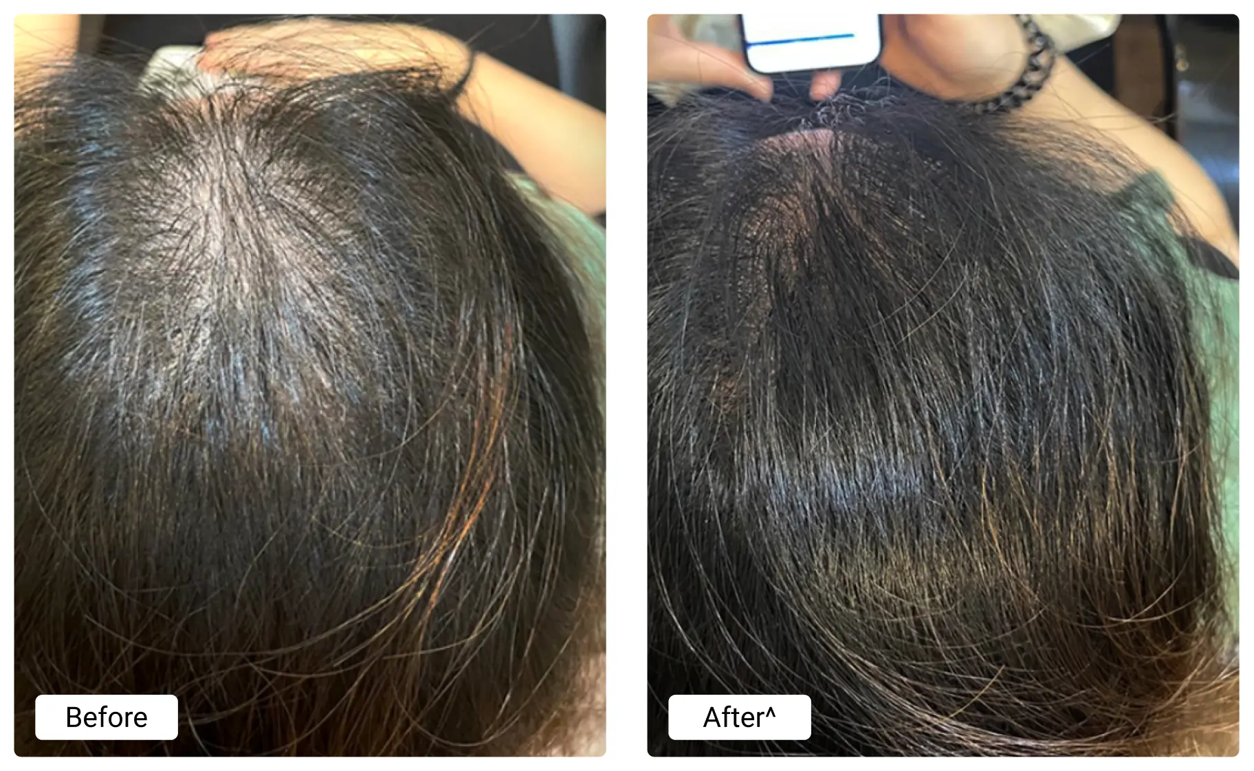 before-and-after (6)